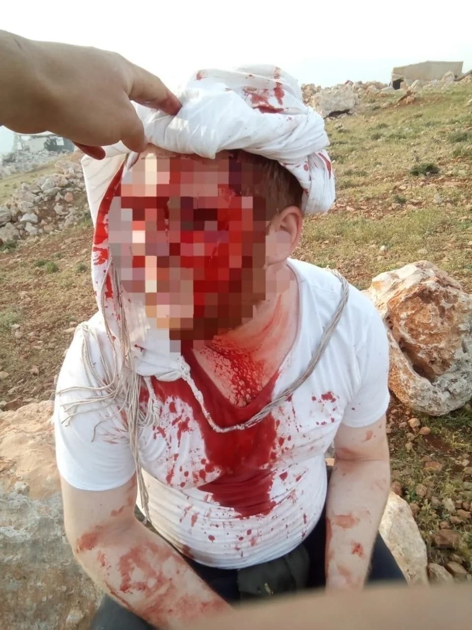 ޔަހޫދީނކަލޭގެ ގައިގައި ތަޅާލާފައި