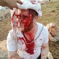 ޔަހޫދީނކަލޭގެ ގައިގައި ތަޅާލާފައި